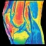 Color Mapping Knee MRI